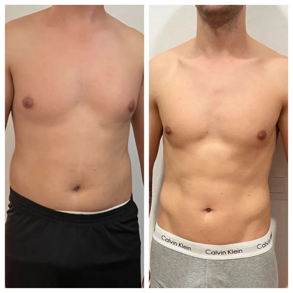 Transformación de torso con pérdida de grasa abdominal
